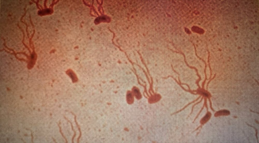 Photomicrograph of Salmonella Typhi bacteria with a flagellar stain