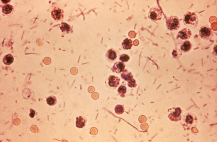 Microscopy of a stool sample containing Shigella bacteria