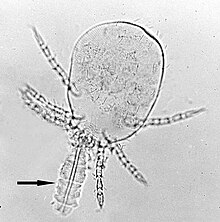 Microscopy of a Trombicula mite larva with its stylostome feeding tube